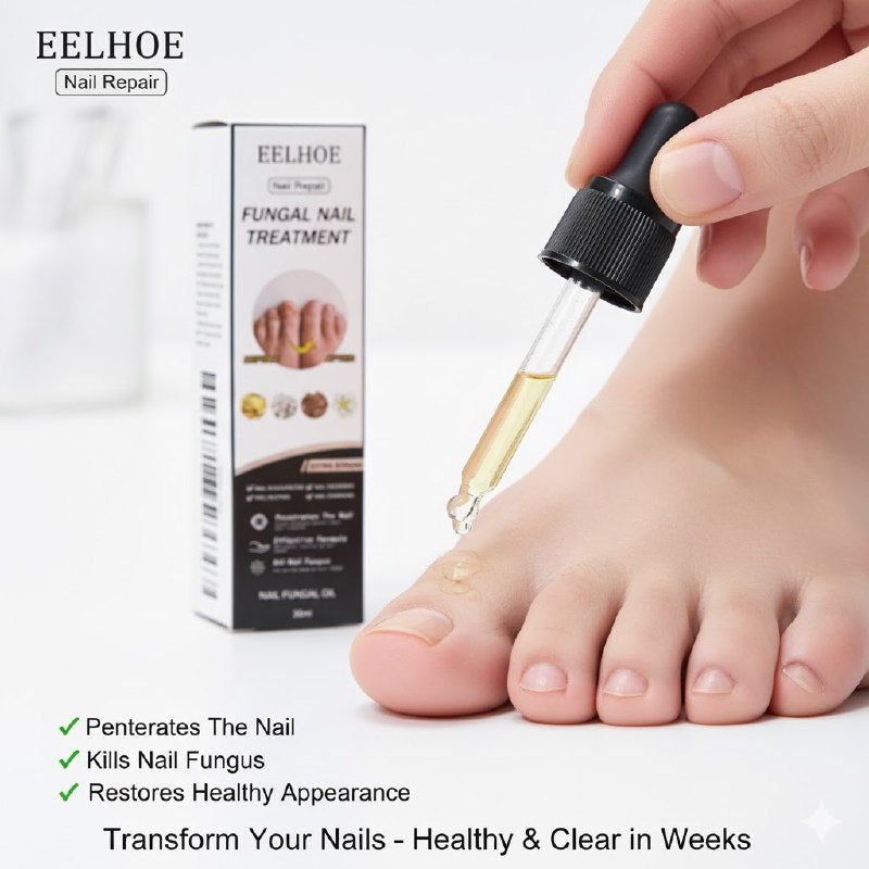 TRATAMIENTO ANTIFUNGICO REPARADOR PARA UÑAS INTENSIVO EELHOE 30ML