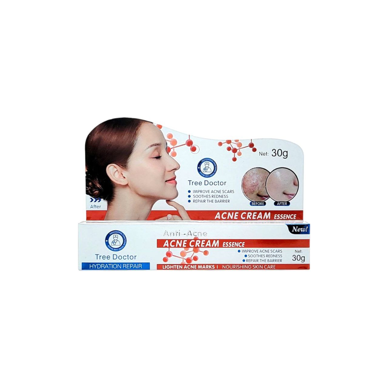 CREMA FACIAL ANTI ACNE TREE DOCTOR 30G