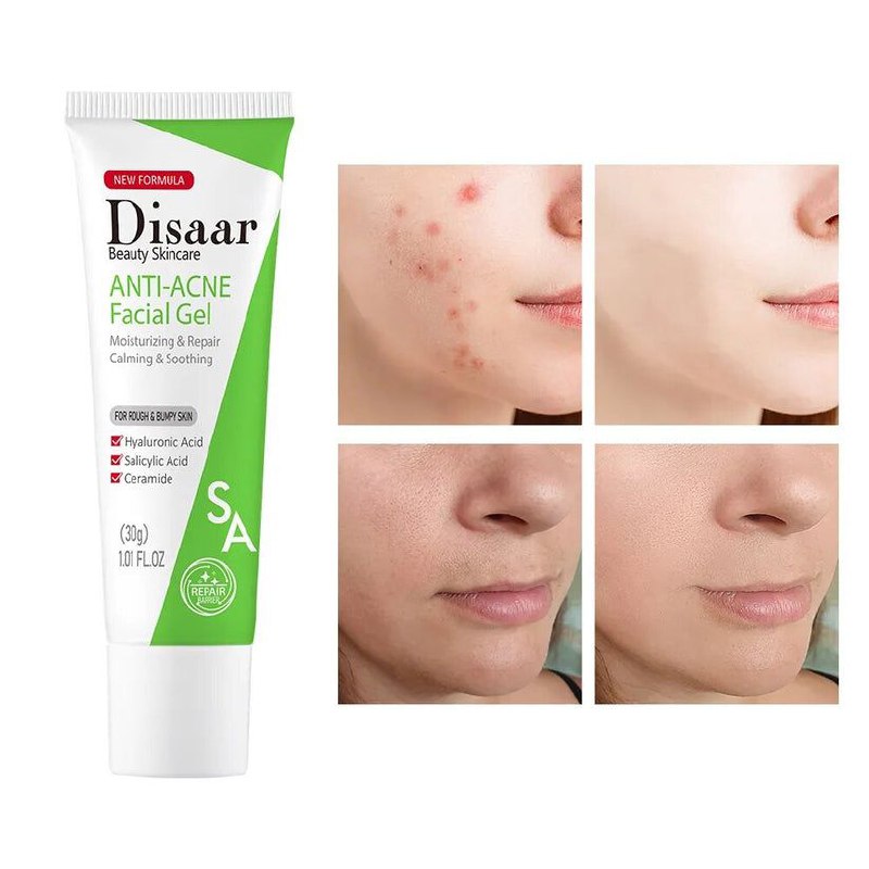 CREMA FACIAL EN GEL ANTI ACNE DISAAR 30G